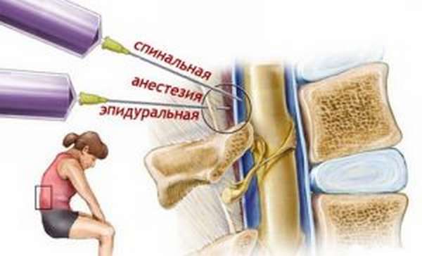 Наркоз при артроскопии коленного сустава